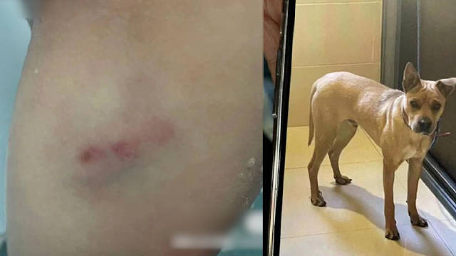 孕妇被狗咬 主人称狗咬的让狗道歉