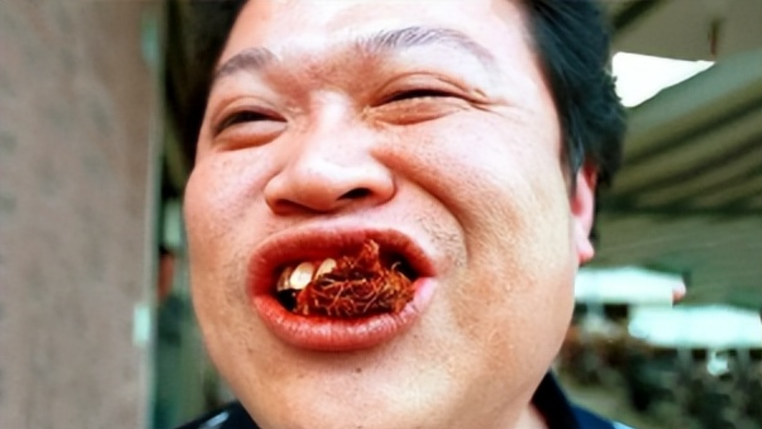 男子嚼槟榔15年脸已腐烂