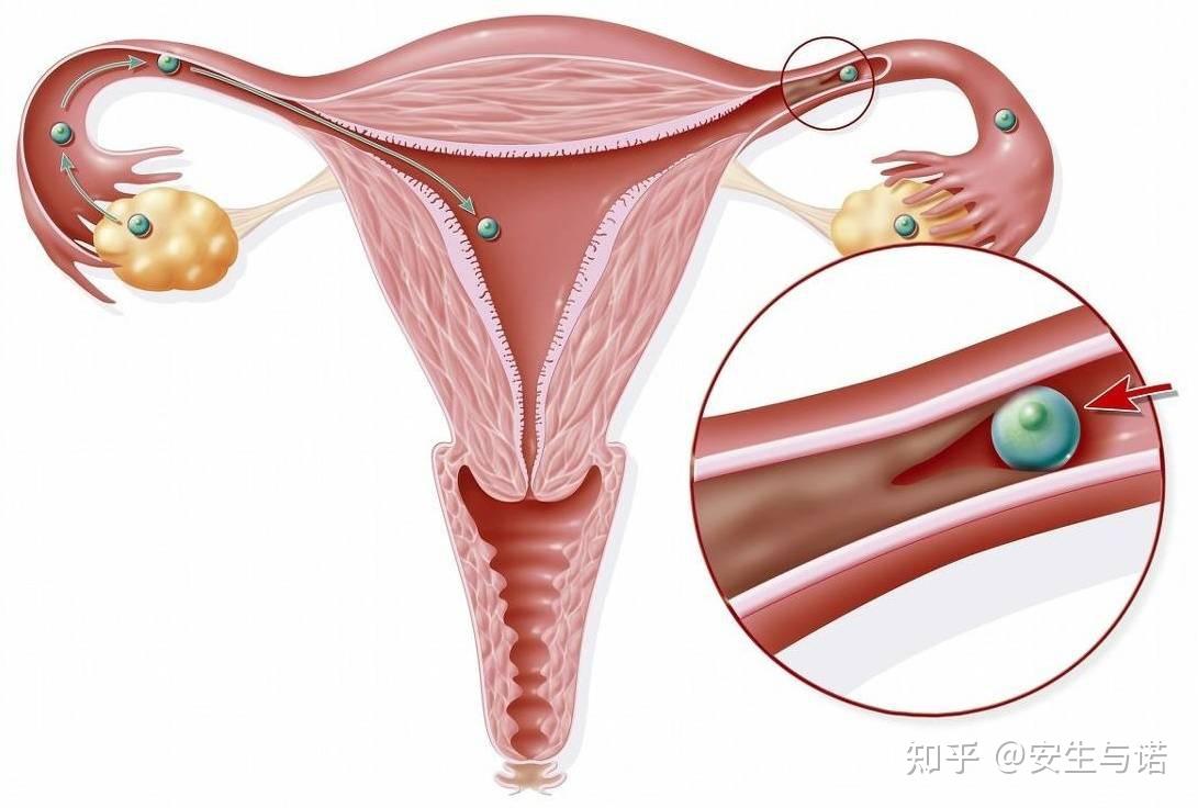 震惊！25岁女孩婚前体检时才发现无子宫，她的未来将何去何从？